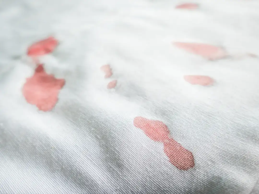 Czy Vanish usuwa plamy z krwi? Sprawdź jego skuteczność na tkaninach