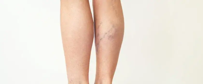 Do jakiego lekarza zgłosić się z zakrzepicą: kompletna lista specjalistów