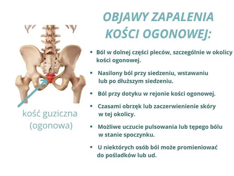 Ból kości ogonowej: Przyczyny, objawy i skuteczne leczenie