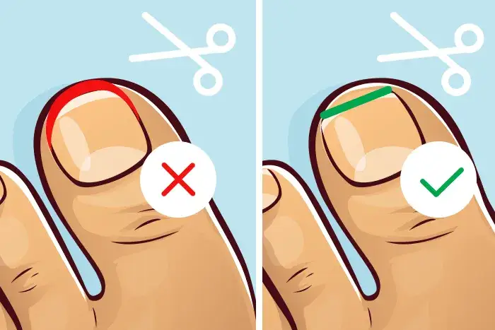 Jak bezpiecznie obcinać dziecku paznokcie u nóg - porady dla rodziców