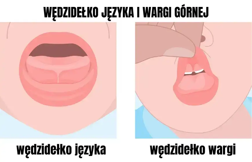 Podcięcie wędzidełka: Kiedy ćwiczyć, a kiedy sport? Poradnik