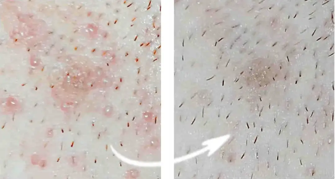 Woda po goleniu po co? Odkryj jej niespodziewane korzyści dla skóry