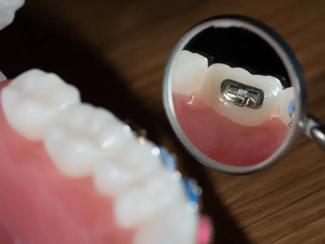 Fotografia stomatologiczna - Jakie rodzaje ujęć są najważniejsze?