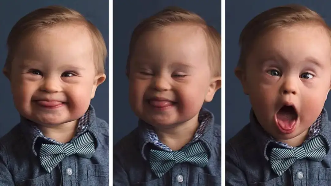 Jak adoptować dziecko z zespołem Downa - krok po kroku do szczęścia