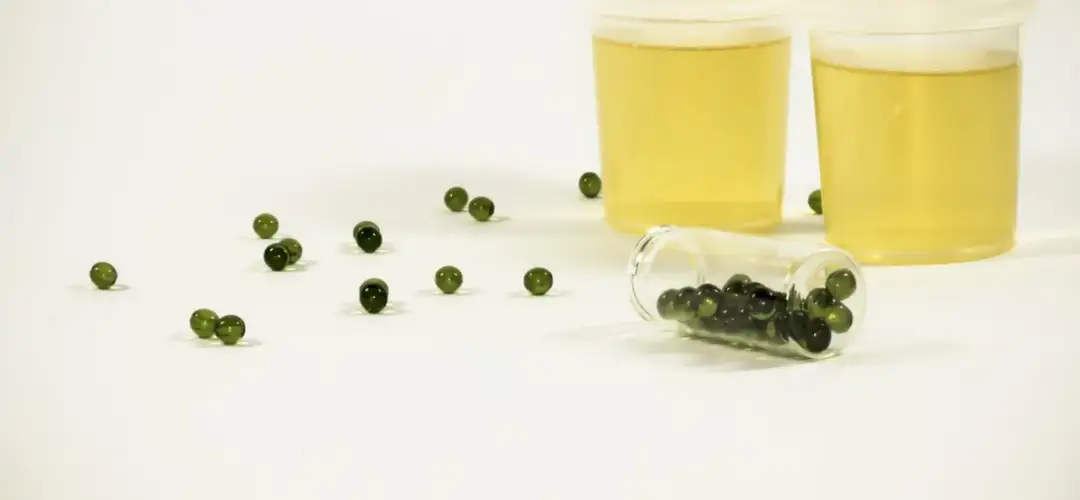 Co mogą odsłonić badania metaboliczne OAT? Poznaj możliwości.