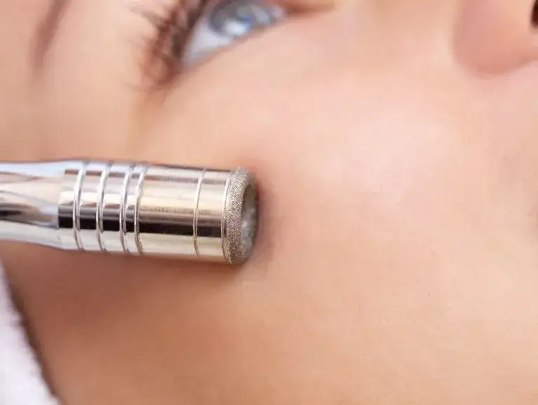 Jak często robić mikrodermabrazję, by uniknąć uszkodzeń skóry?