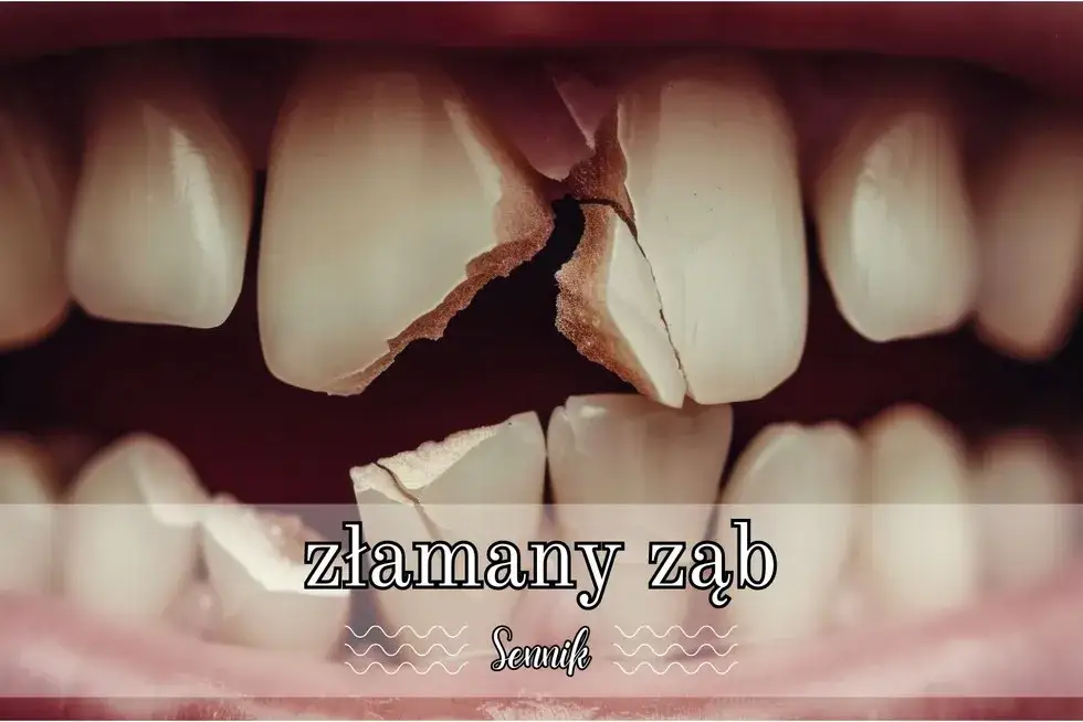 Znaczenie złamanego zęba w senniku - Co przepowiada ten niepokojący sen