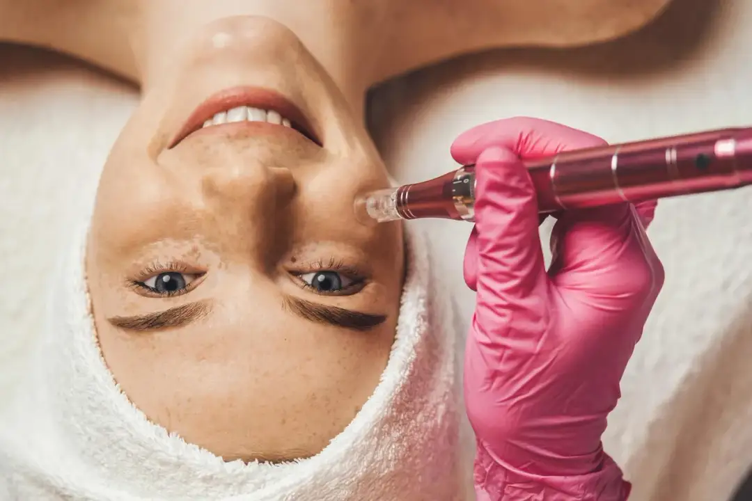 Poznaj najlepsze kremy po mezoterapii mikroigłowej - skuteczna regeneracja