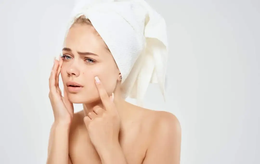 Jaki hydrolat do cery trądzikowej? Odkryj najlepsze rozwiązania dla skóry