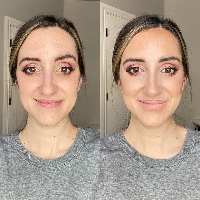 Jak skutecznie pozbyć się tłustej cery – sprawdzone metody i porady