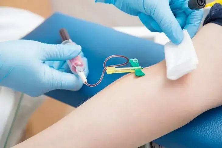 Podwyższony poziom androstendionu: przyczyny, objawy i skuteczne leczenie