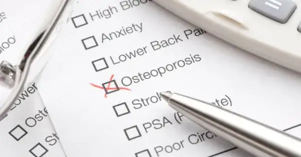 Jak wygląda badanie na osteoporozę? Co musisz wiedzieć przed testem