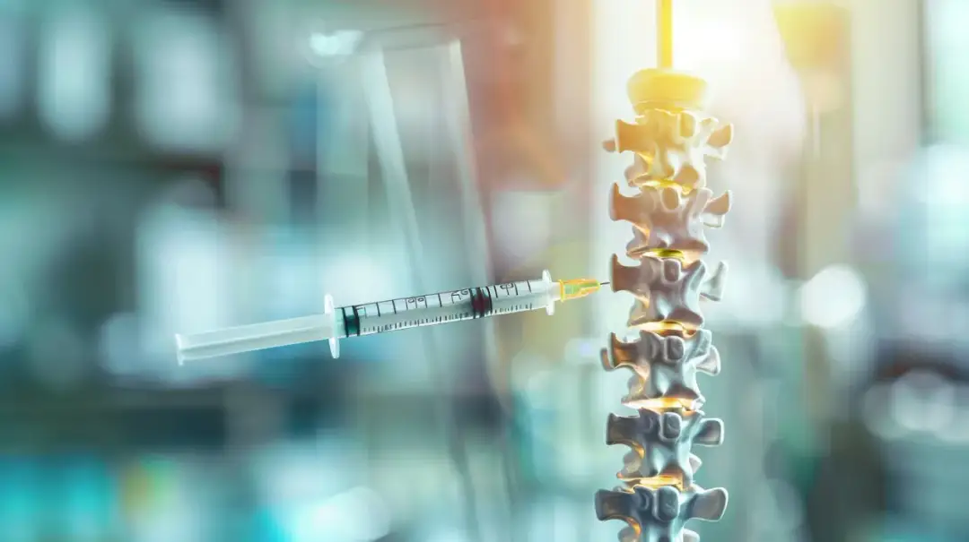 Igła do punkcji lędźwiowej: Co musisz wiedzieć przed zabiegiem?