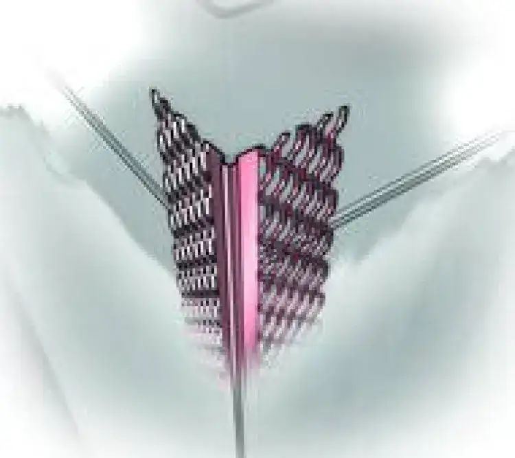 Jakie narożniki do tynków gipsowych wybrać, by uniknąć problemów?