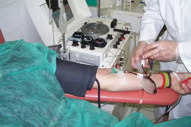 Co ile można oddać płytki krwi? Poznaj częstotliwość donacji