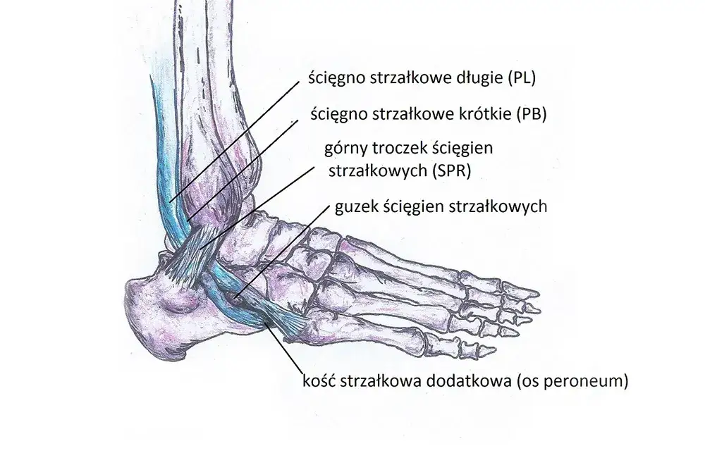 Naciągnięcie ścięgna w stopie: rozpoznaj objawy i zacznij leczenie