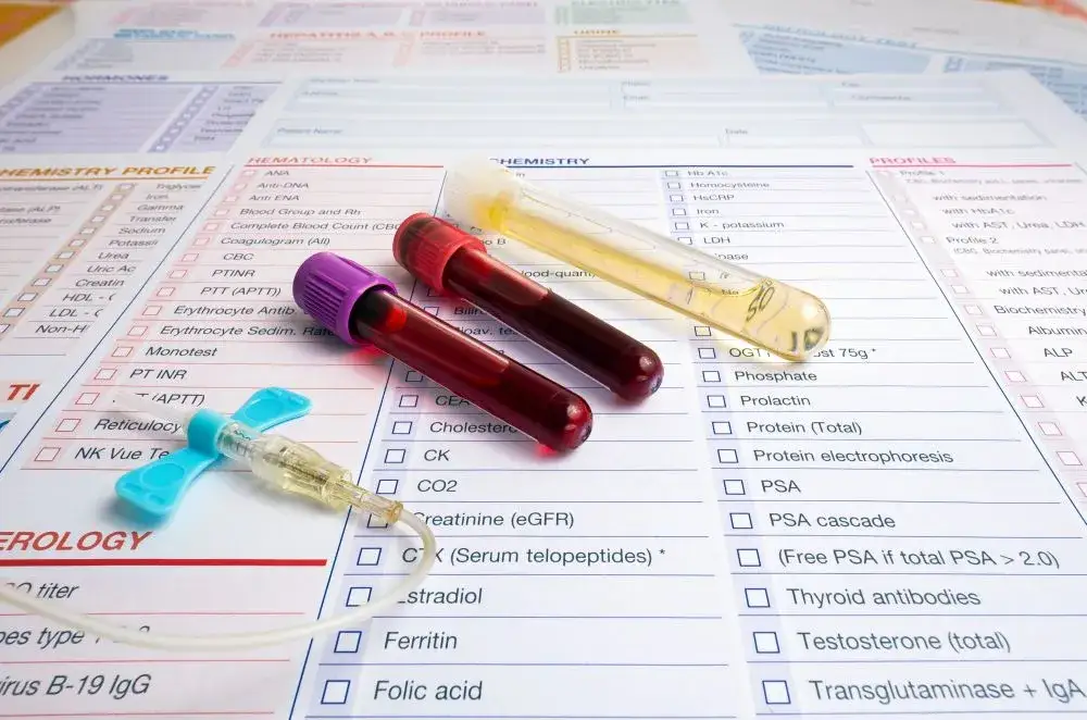 Jakie badanie krwi wykryje raka: poznaj najważniejsze markery nowotworowe