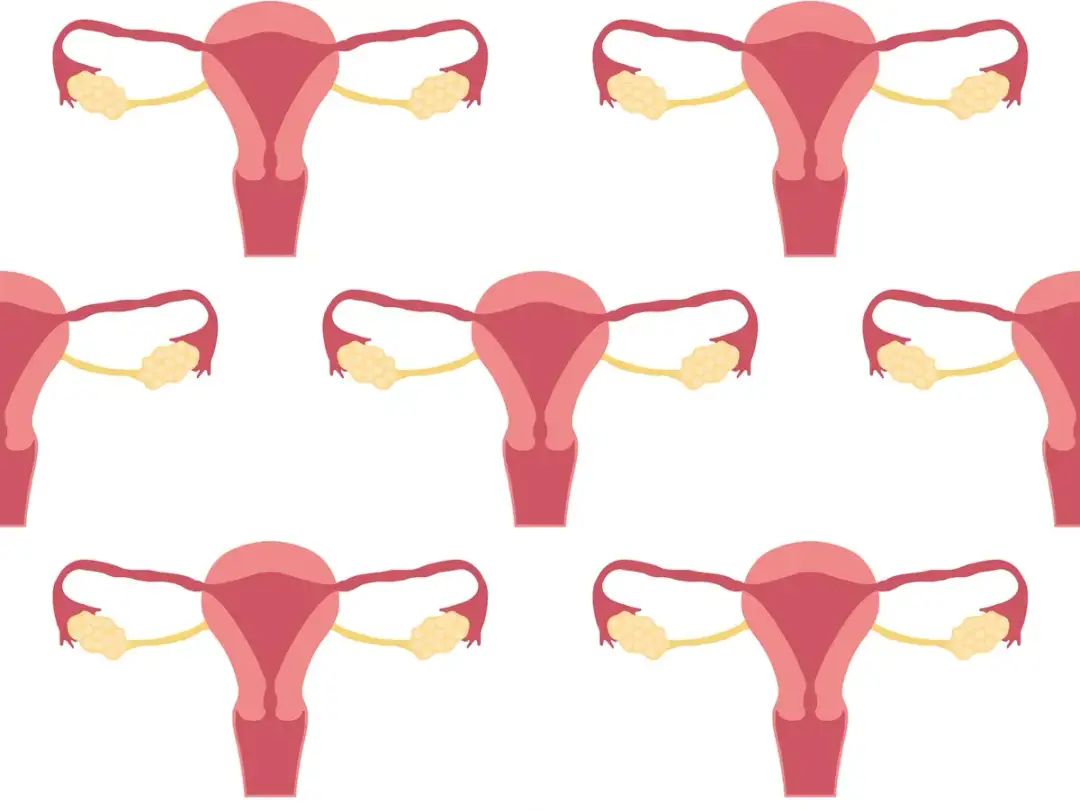 Podwyższony poziom CA 125 - co naprawdę oznacza w wynikach badań