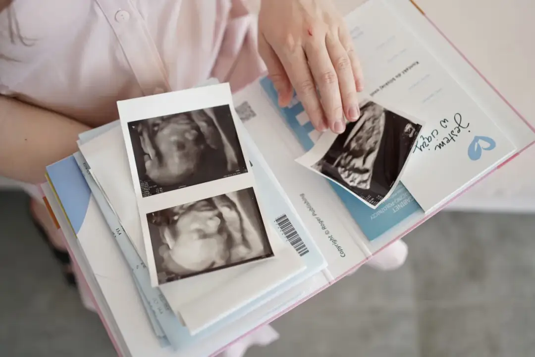 Ile powinna przytyć w ciąży? Sprawdź, co jest naprawdę zdrowe