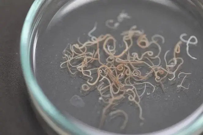 Jakie badanie na glistę ludzką? Kluczowe informacje o diagnostyce