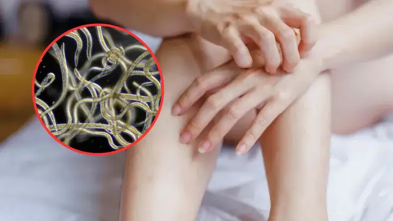 Pasożyty u dzieci: 7 objawów, które przerażają rodziców. Pomoc