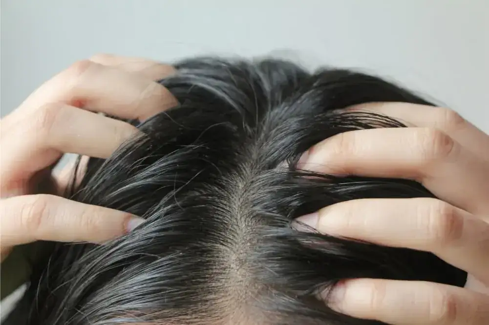 Dlaczego włosy szybko się przetłuszczają i wypadają? Poznaj skuteczne metody