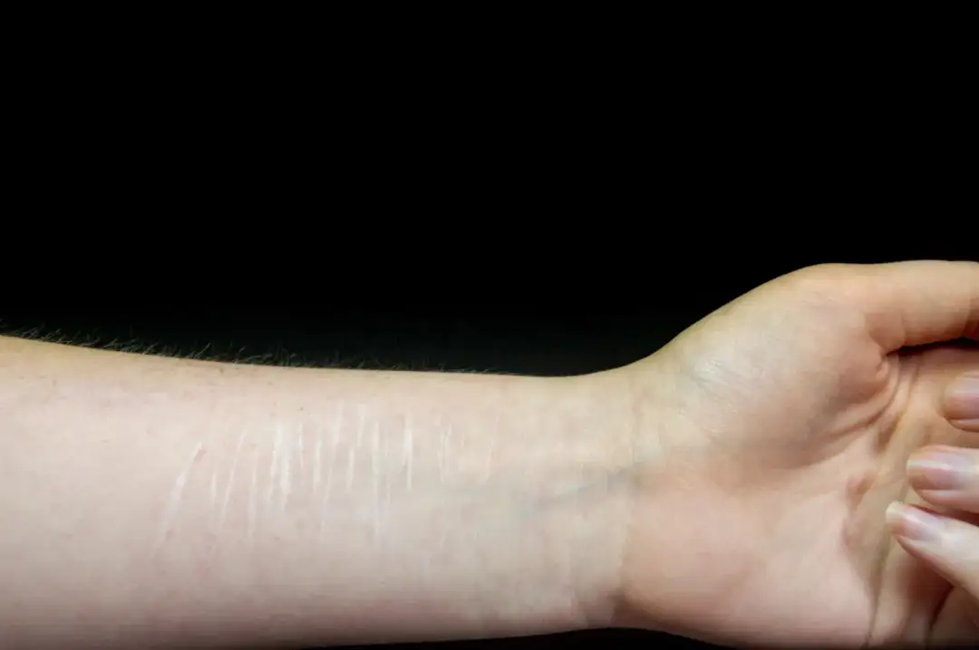 Samookaleczanie nie zawsze jest grzechem - co mówi Kościół i Biblia