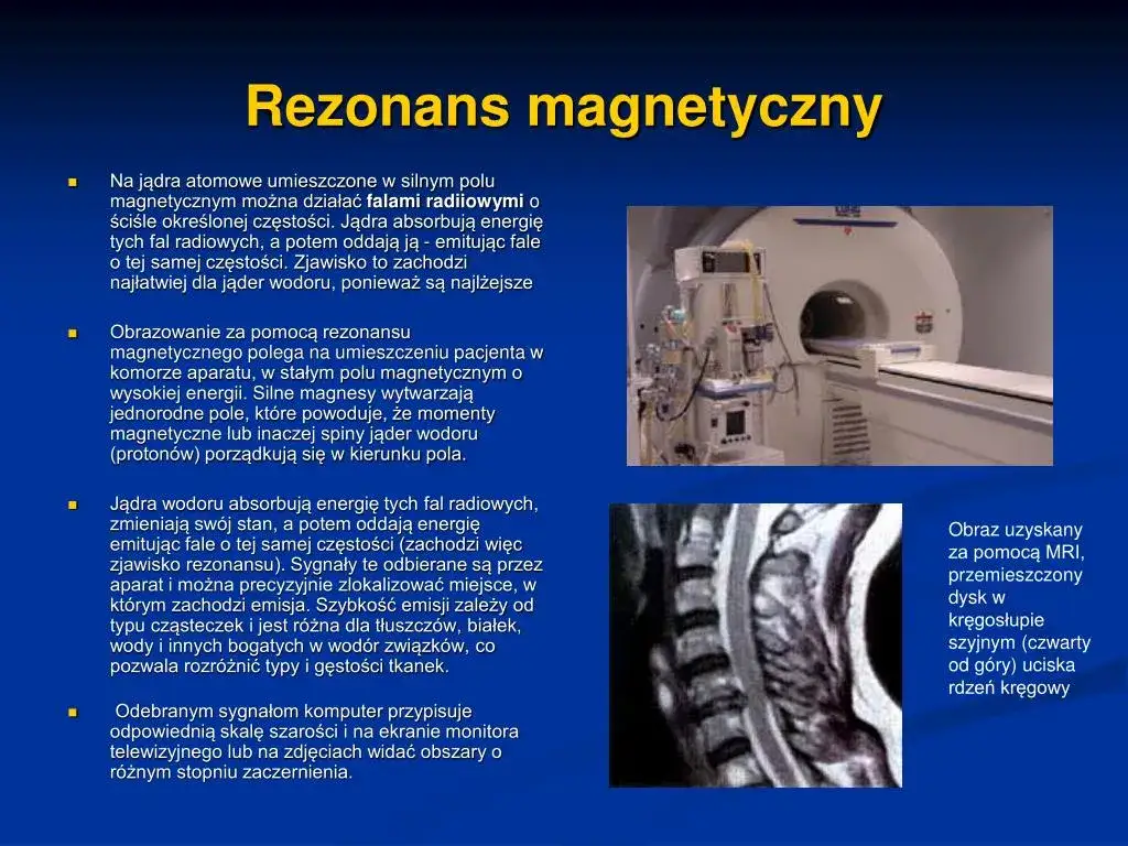 Co to jest rezonans magnetyczny? Fizyczne podstawy zjawiska prosto wyjaśnione