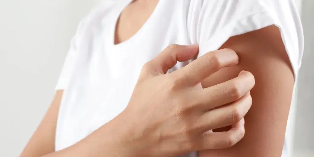 Ugryzienie meszki objawy: jak rozpoznać i leczyć skutki ugryzienia