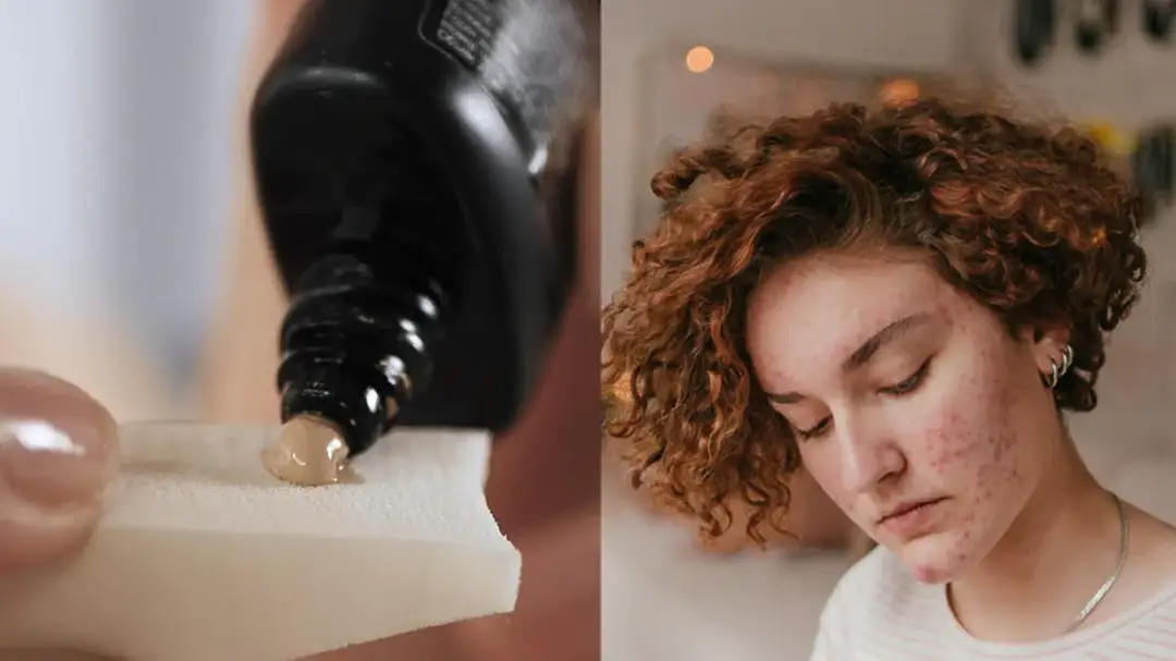 Jaki krem BB do cery trądzikowej, który naprawdę działa na skórę?