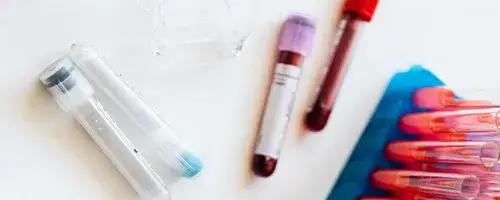 Co to jest GGTP w badaniu krwi i jak wpływa na zdrowie wątroby?