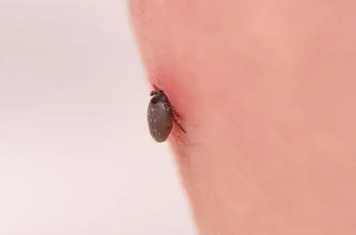 Jak wyjąć głowę kleszcza i uniknąć poważnych problemów zdrowotnych