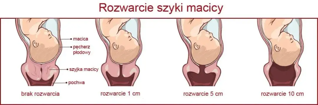 Rozwarcie na 2 palce: ile cm to jest i co oznacza w porodzie?