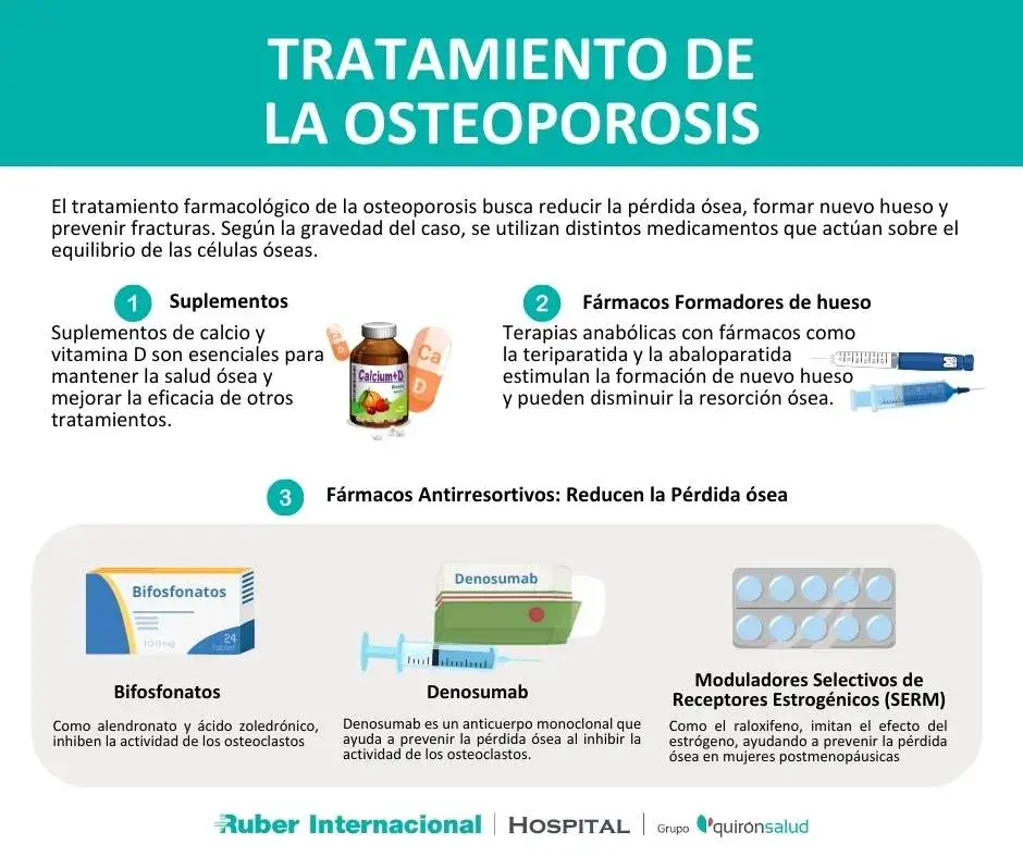 Medicamentos para la osteoporosis: opciones efectivas y riesgos a considerar