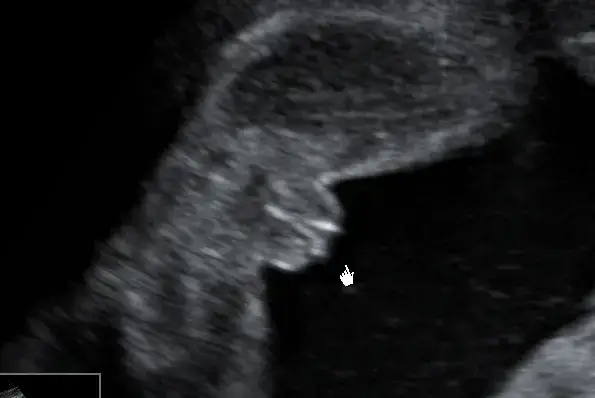 Kiedy w ciąży można poznać płeć dziecka? Oto najważniejsze informacje