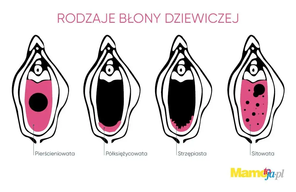 Czy mężczyzna czuje przebicie błony dziewiczej? Oto prawda, której nie znasz