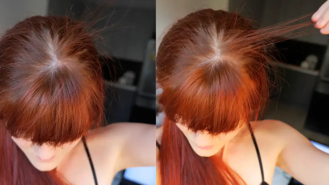 Skuteczne leki na wypadanie włosów, które naprawdę działają