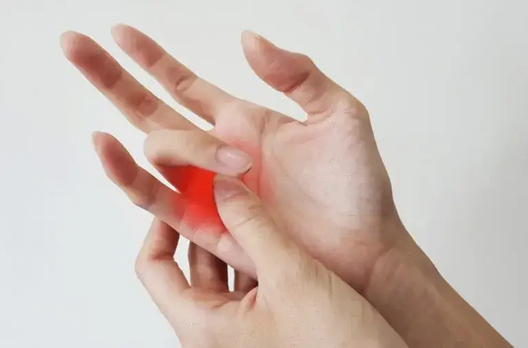 Jak skręcić rękę: skuteczne metody leczenia i objawy do obserwacji