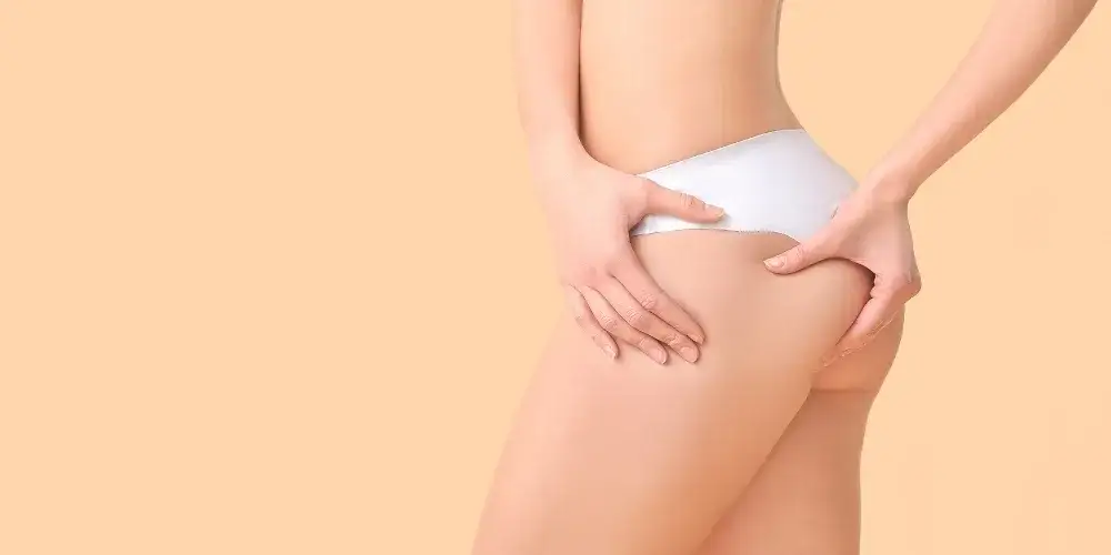 Cellulit na udach: Skuteczne metody i triki do gładkiej skóry.