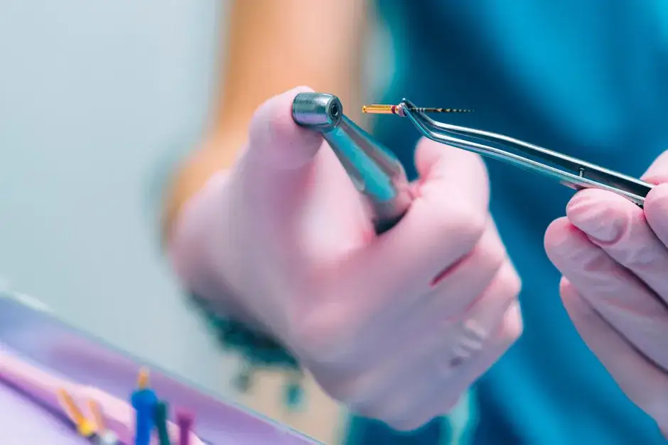 Ile kosztuje leczenie kanałowe na nfz? Sprawdź ceny i warunki