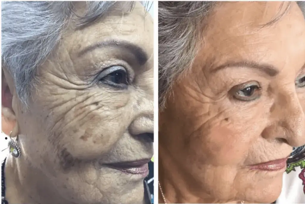 Gdzie kupić deep phyto peeling? Sprawdź najlepsze opcje i miejsca