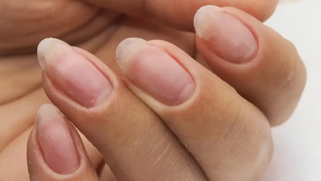 Dłonie z krótkimi, naturalnymi paznokciami. Chcesz wiedzieć, jak szybko zapuścić paznokcie? Zadbaj o nie!