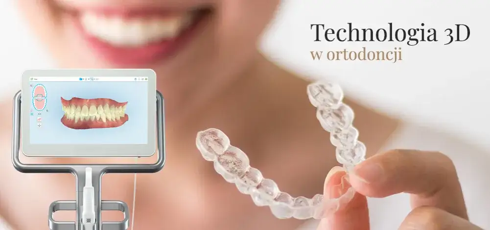 Nakładki na zęby czy aparat - co wybrać dla idealnego uśmiechu?