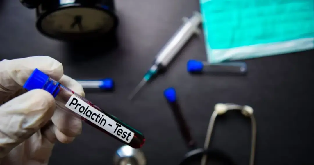 Podwyższony poziom prolaktyny u mężczyzn - co oznacza i jak go leczyć