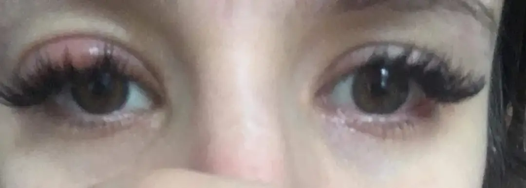 Uczulenie na tusz do rzęs objawy – jak je rozpoznać i unikać?