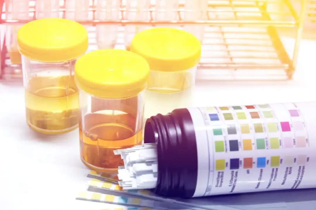 Ile kosztuje badanie moczu? Sprawdź ceny w Polsce i oszczędź