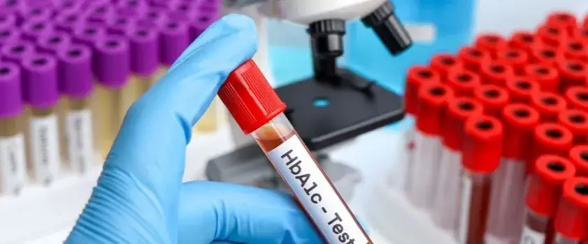 Ile kosztuje badanie hba1c? Sprawdź ceny i ważne informacje