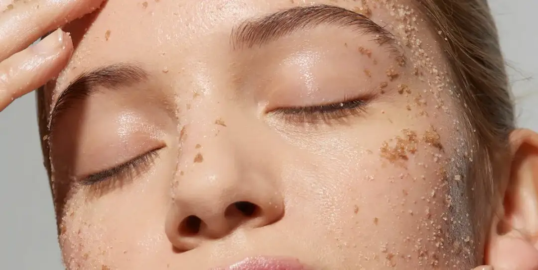 Cómo el acné cosmético puede arruinar tu piel y cómo evitarlo