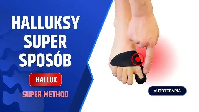 Jak tejpować haluksa, aby złagodzić ból i poprawić komfort stóp
