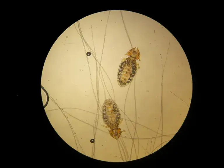 Jak rozpoznać wszoły u kota? Objawy i metody skutecznego leczenia